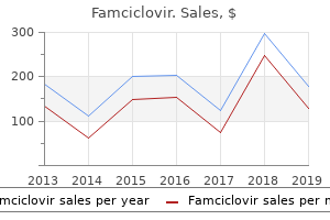 cheap 250 mg famciclovir otc