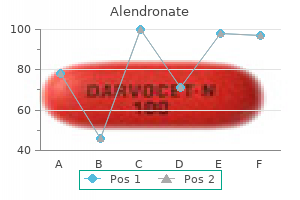alendronate 35mg with amex