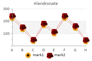 buy alendronate line