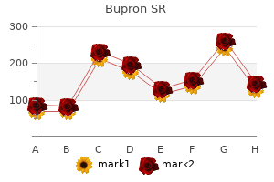 bupron sr 150mg cheap