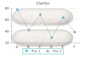 order line claritin