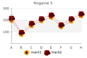 buy 60ml rogaine 5 amex