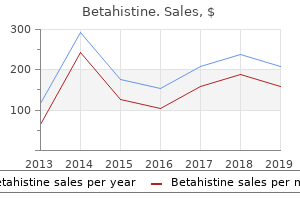 order 16mg betahistine fast delivery