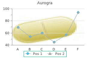 purchase aurogra master card