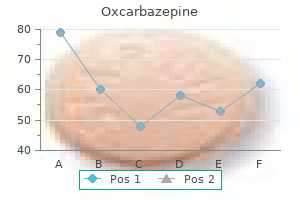 discount oxcarbazepine 300mg with visa
