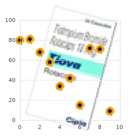 Tachycardia