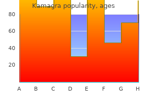 order 100 mg kamagra amex