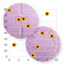 Congenital giant megaureter